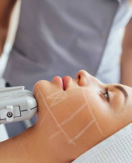 Safe and effective radiofrequency skin tightening treatment to reduce wrinkles and sagging, enhancing skin's firmness and elasticity.